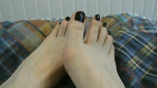 Finally, black polish! And some scars too. - Feet