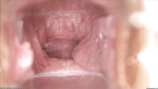 Insides of a vagina slowly closing up - Confused Boners